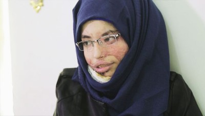 "العنود شريان" ضحية زواج الأطفال في اليمن تروي قصتها