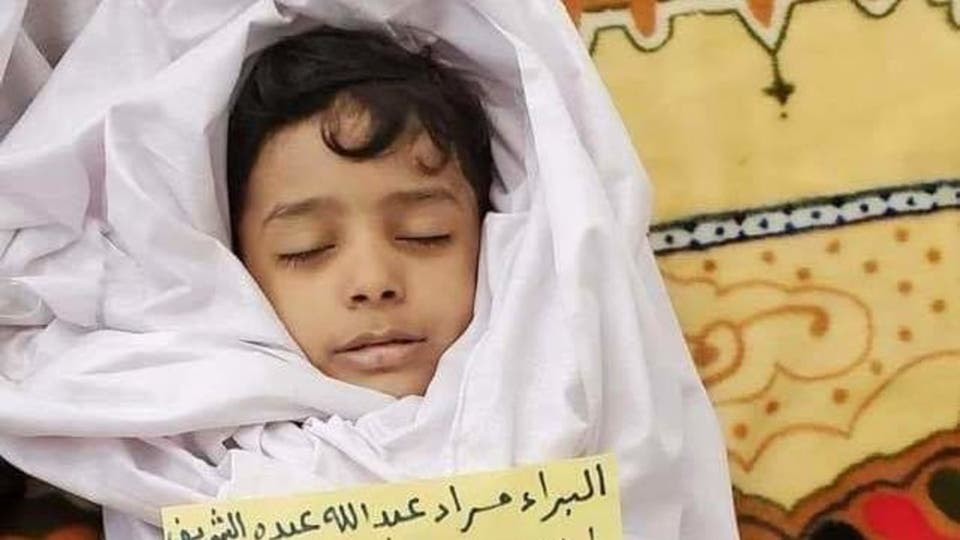 وفاة الطفل "البراء الشريف" متأثرا بإصابته بقذيفة حوثية